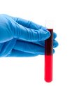The researchers’ hypothesis is that acute myeloid leukaemia returns in the patients due to the leukaemia stem cells in the body, as it is often not possible to remove them using chemotherapy.
