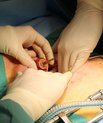 Implantatet er fremstillet af polycaprolactone, som allerede er godkendt til implantatbrug. Det passer til alle de specielle clipsemaskiner, der findes på markedet for operationsudstyr. Foto: Marianne Lie Becker.