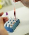 Det vil gavne dansk sundhedsvidenskabelig forskning, hvis patienter kan give forskere adgang til deres sundhedsoplysninger, mener kronikørerne.